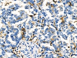 Invitrogen FCGR2A Polyclonal Antibody 100 &mu;L; Unconjugated:Antibodies,