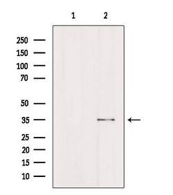 Invitrogen FCGR2A Polyclonal Antibody 100 &mu;L; Unconjugated:Antibodies,