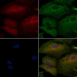 Invitrogen HLA-DR/DP Polyclonal Antibody 100 &mu;L | Buy Online | Invitrogen&trade; | Fisher Scientific