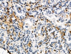 Invitrogen HLA-DR/DP Polyclonal Antibody 100 &mu;L | Buy Online | Invitrogen&trade; | Fisher Scientific