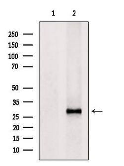 Invitrogen HLA-DR/DP Polyclonal Antibody 100 &mu;L | Buy Online | Invitrogen&trade; | Fisher Scientific