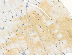 Invitrogen TLR8 Polyclonal Antibody 100 &mu;L | Buy Online | Invitrogen&trade; | Fisher Scientific