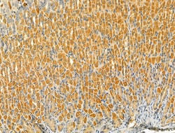 Invitrogen TLR8 Polyclonal Antibody 100 &mu;L | Buy Online | Invitrogen&trade; | Fisher Scientific