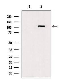 Invitrogen TLR8 Polyclonal Antibody 100 &mu;L | Buy Online | Invitrogen&trade; | Fisher Scientific