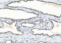 Invitrogen RBBP4 Polyclonal Antibody 100 &mu;L; Unconjugated:Antibodies,