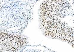 Invitrogen RBBP4 Polyclonal Antibody 100 &mu;L; Unconjugated:Antibodies,