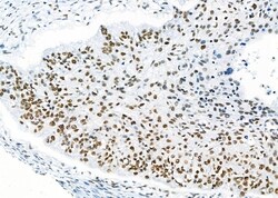 Invitrogen RBBP4 Polyclonal Antibody 100 &mu;L; Unconjugated:Antibodies,