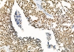 Invitrogen RBBP4 Polyclonal Antibody 100 &mu;L; Unconjugated:Antibodies,