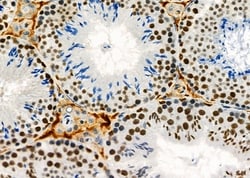 Invitrogen RBBP4 Polyclonal Antibody 100 &mu;L; Unconjugated:Antibodies,