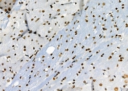 Invitrogen RBBP4 Polyclonal Antibody 100 &mu;L; Unconjugated:Antibodies,