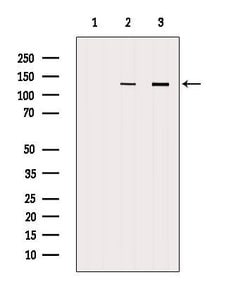 Invitrogen RENT1 Polyclonal Antibody 100 &mu;L; Unconjugated:Antibodies,