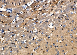 Invitrogen RENT1 Polyclonal Antibody 100 &mu;L; Unconjugated:Antibodies,