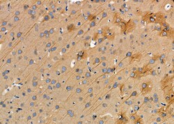 Invitrogen RENT1 Polyclonal Antibody 100 &mu;L; Unconjugated:Antibodies,