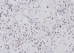 Invitrogen NFATC1 Polyclonal Antibody 100 &mu;L | Buy Online | Invitrogen&trade; | Fisher Scientific