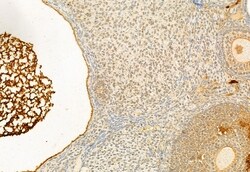 Invitrogen NFATC1 Polyclonal Antibody 100 &mu;L | Buy Online | Invitrogen&trade; | Fisher Scientific