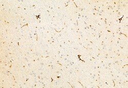 Invitrogen NFATC1 Polyclonal Antibody 100 &mu;L | Buy Online | Invitrogen&trade; | Fisher Scientific