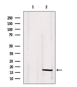Invitrogen Angiogenin Polyclonal Antibody 100 &mu;L; Unconjugated:Antibodies,