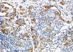 Invitrogen PAH Polyclonal Antibody 100 &mu;L; Unconjugated:Antibodies,