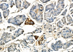 Invitrogen IL-6R Polyclonal Antibody 100 &mu;L; Unconjugated:Antibodies,