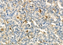 Invitrogen IL-6R Polyclonal Antibody 100 &mu;L; Unconjugated:Antibodies,