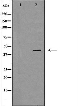 Invitrogen Haptoglobin Polyclonal Antibody 100 &mu;L; Unconjugated:Antibodies,