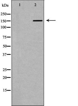Invitrogen A2M Polyclonal Antibody 100 &mu;L | Buy Online | Invitrogen&trade; | Fisher Scientific