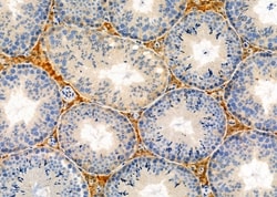Invitrogen Factor IX Polyclonal Antibody 100 &mu;L; Unconjugated:Antibodies,