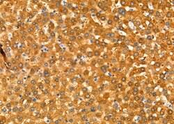 Invitrogen Factor IX Polyclonal Antibody 100 &mu;L; Unconjugated:Antibodies,
