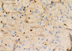 Invitrogen Factor IX Polyclonal Antibody 100 &mu;L; Unconjugated:Antibodies,
