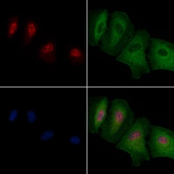 Invitrogen PXR Polyclonal Antibody 100 &mu;L; Unconjugated:Antibodies,