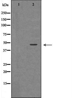 Invitrogen Renin Polyclonal Antibody 100 &mu;L; Unconjugated:Antibodies,