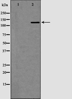 Invitrogen XPG Polyclonal Antibody 100 &mu;L | Buy Online | Invitrogen&trade; | Fisher Scientific
