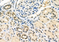 TAP2 Polyclonal Antibody:Antibodies, Polyclonal