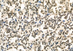 TAP2 Polyclonal Antibody:Antibodies, Polyclonal