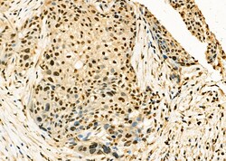 TAP2 Polyclonal Antibody:Antibodies, Polyclonal