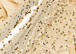 TAP2 Polyclonal Antibody:Antibodies, Polyclonal