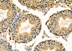 TAP2 Polyclonal Antibody:Antibodies, Polyclonal