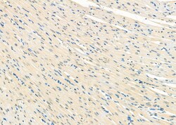 TAP2 Polyclonal Antibody:Antibodies, Polyclonal