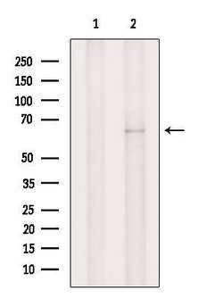 TAP2 Polyclonal Antibody:Antibodies, Polyclonal