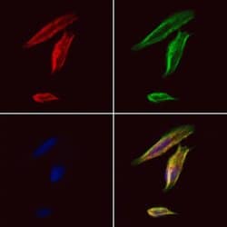 Invitrogen HLA-DRB3 Polyclonal Antibody 100 &mu;L; Unconjugated:Antibodies,
