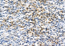 Invitrogen HLA-DRB3 Polyclonal Antibody 100 &mu;L; Unconjugated:Antibodies,
