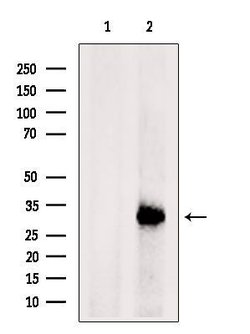 Invitrogen HLA-DRB3 Polyclonal Antibody 100 &mu;L; Unconjugated:Antibodies,