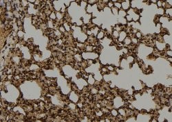 Invitrogen MUTYH Polyclonal Antibody 100 &mu;L; Unconjugated:Antibodies,