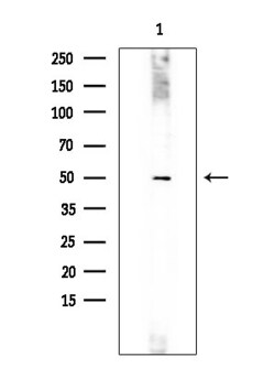 Invitrogen IL23R Polyclonal Antibody 100 &mu;L; Unconjugated:Antibodies,