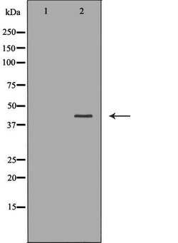 Invitrogen CSNK2A2 Polyclonal Antibody 100 &mu;L; Unconjugated:Antibodies,