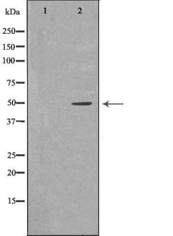 Invitrogen KIR3DL1 Polyclonal Antibody 100 &mu;L; Unconjugated:Antibodies,