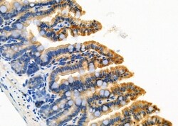 Invitrogen FABP2 Polyclonal Antibody 100 &mu;L | Buy Online | Invitrogen&trade; | Fisher Scientific