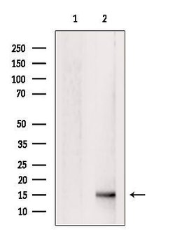 Invitrogen FABP2 Polyclonal Antibody 100 &mu;L | Buy Online | Invitrogen&trade; | Fisher Scientific