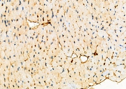 Invitrogen RFC1 Polyclonal Antibody 100 &mu;L; Unconjugated:Antibodies,
