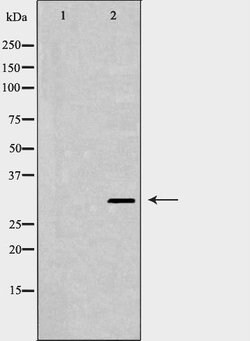 Invitrogen XPA Polyclonal Antibody 100 &mu;L | Buy Online | Invitrogen&trade; | Fisher Scientific